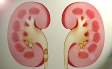 Yapay Böbrek Nakli Nasıl Yapılır?